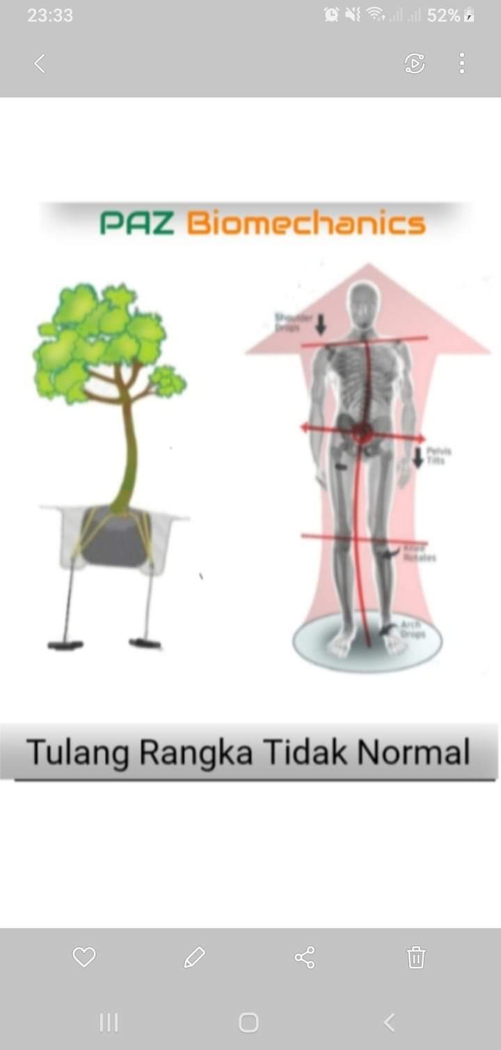 tidak-bisa-jongkok