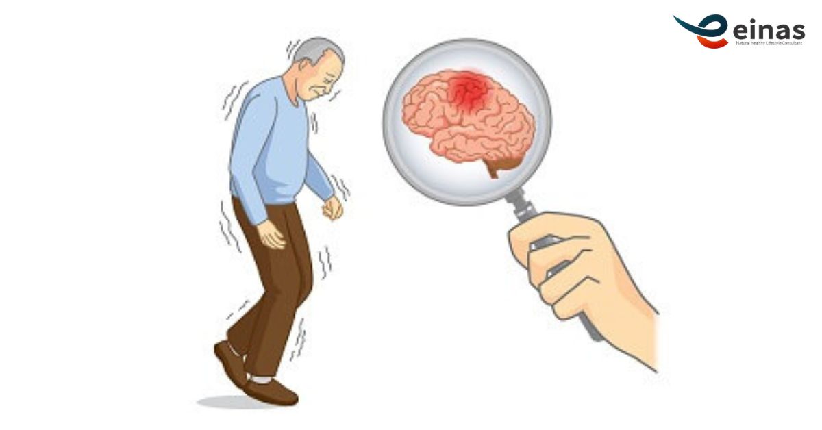 obat-untuk-sakit-parkinson-secara-alami-tanpa-efek-samping