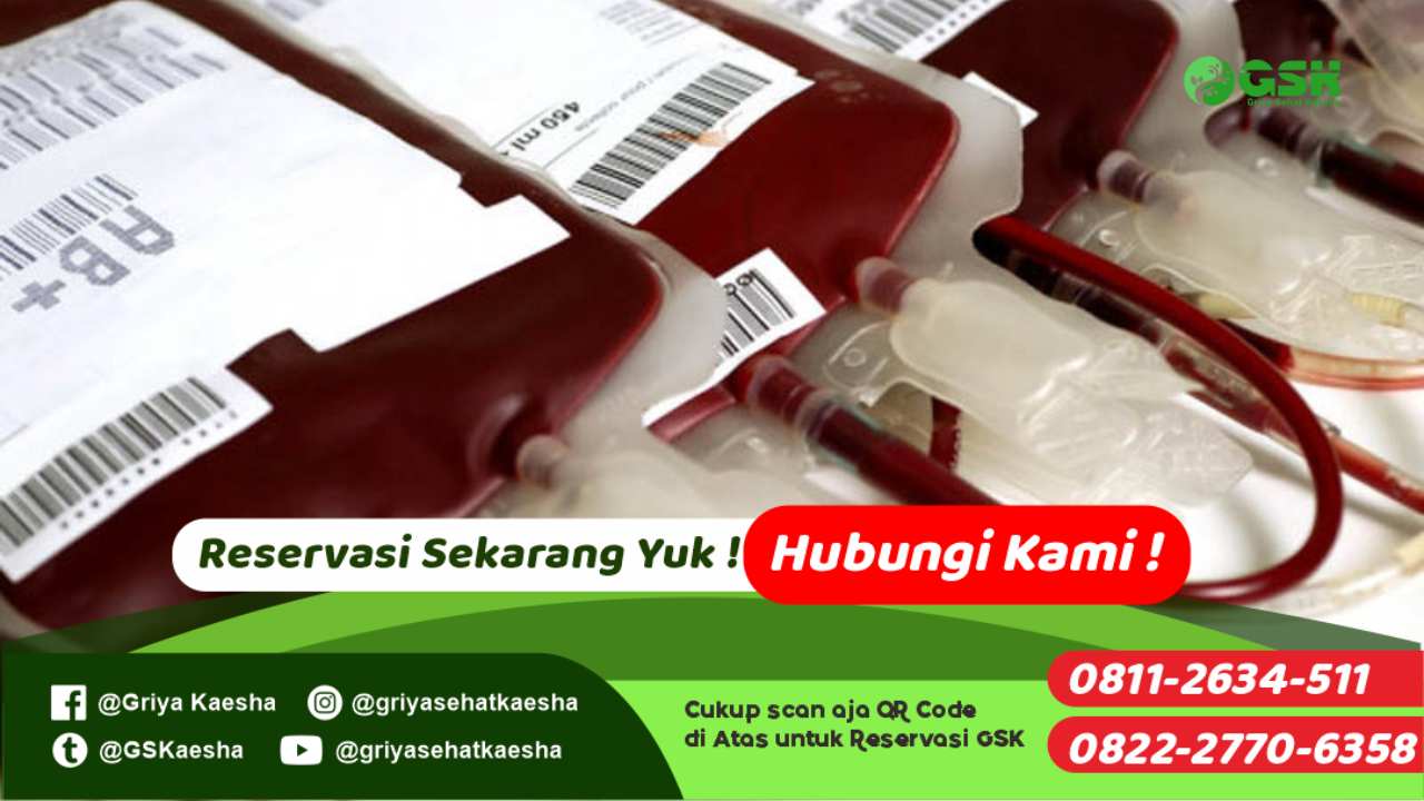 terapi-transfusi-darah-tanpa-obat-dengan-metode-terapi-paz-al-kasaw