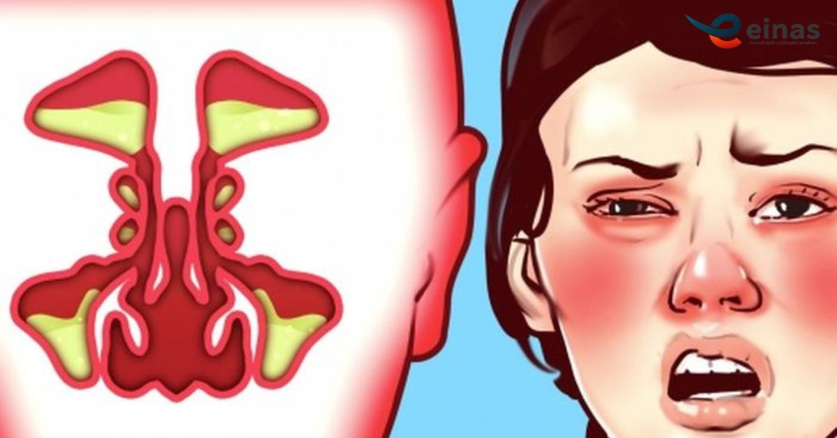 apa-solusi-hidung-tersumbat-ini-dia-cara-alami-dan-terapi-paz-yang-efektif-untuk-atasi-keluhanmu
