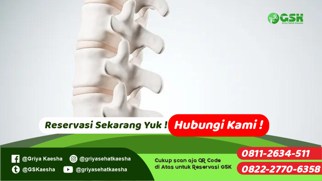 terapi-penyakit-spondylosis-tanpa-obat-dengan-metode-terapi-paz-al-kasaw