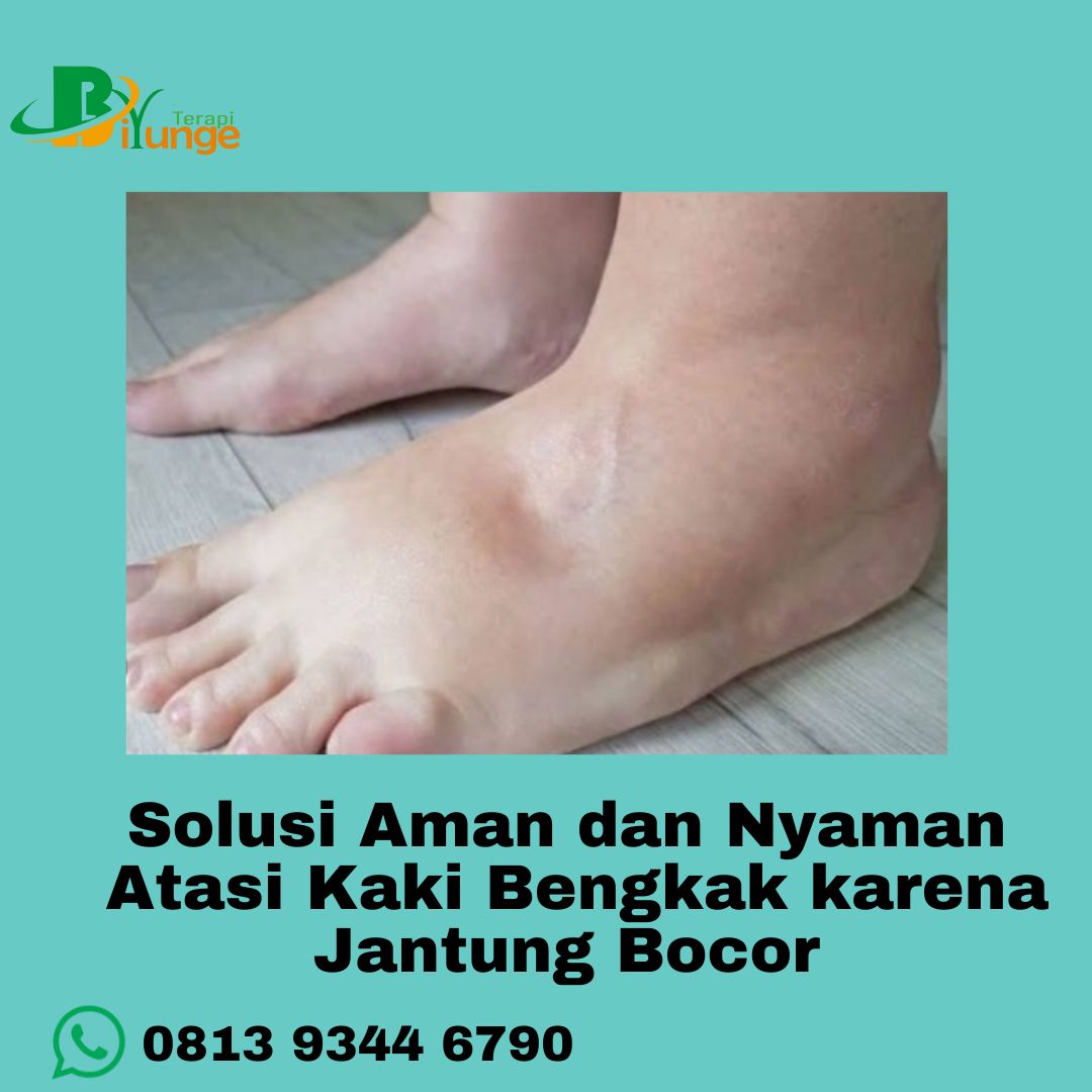 mengatasi-keluhan-pada-jantung-bocor-tanpa-obat