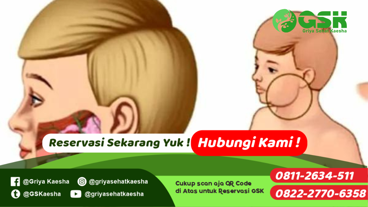 terapi-ada-benjolan-mulai-umur-3-tahun-tanpa-obat-dengan-metode-terapi-paz-al-kasaw