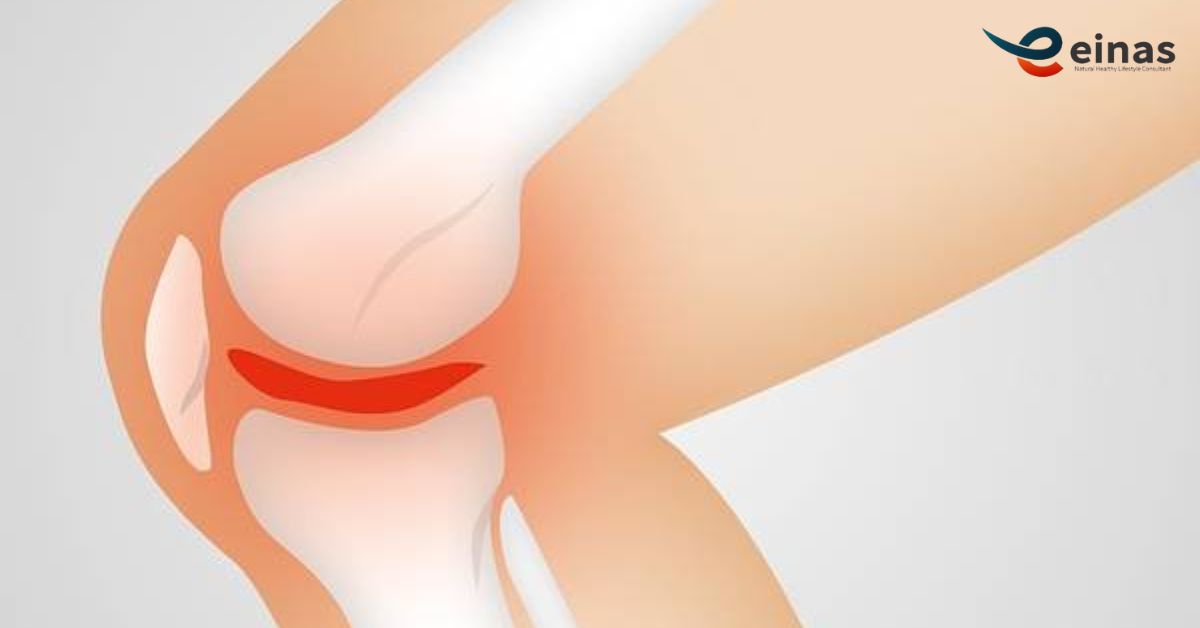 obat-sakit-lutut-kanan-kiri -solusi-alami-yang-sudah-terbukti