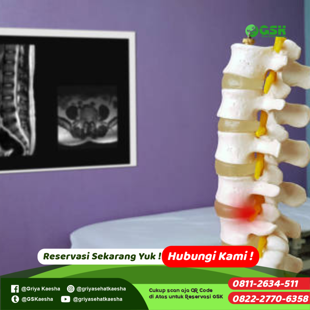 terapi-penyakit-syarat-kejepit-tanpa-obat-dengan-metode-terapi-paz-al-kasaw