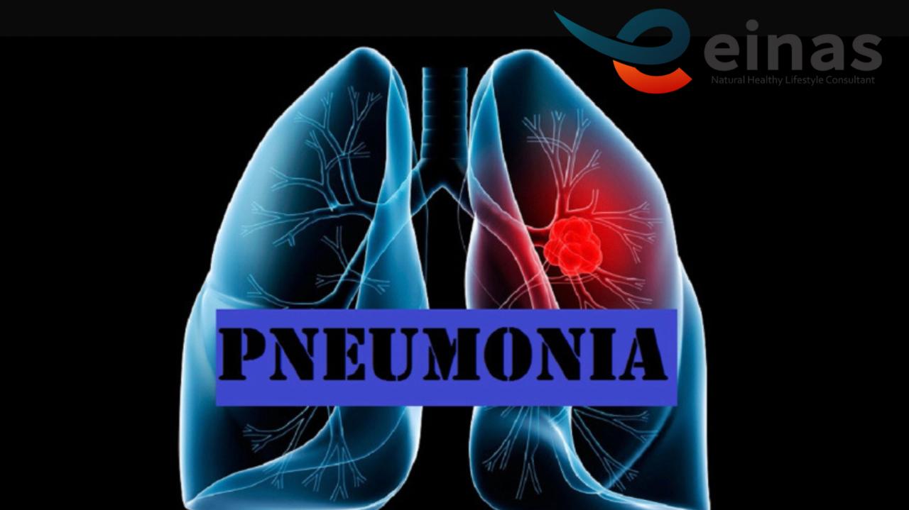 solusi-pneumonia-pada-anak-dengan-metode-paz-al-kasaw