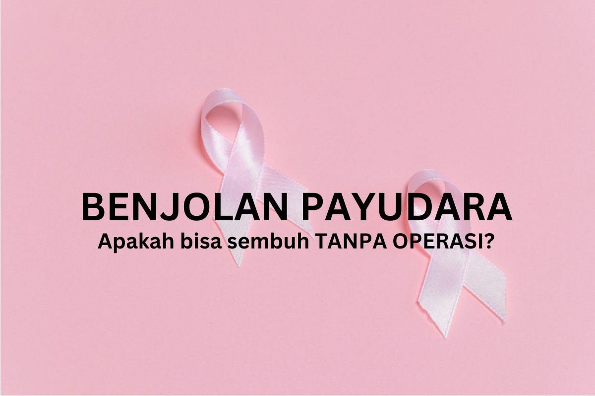 benjolan-payudara-apakah-bisa-sembuh-tanpa-operasi