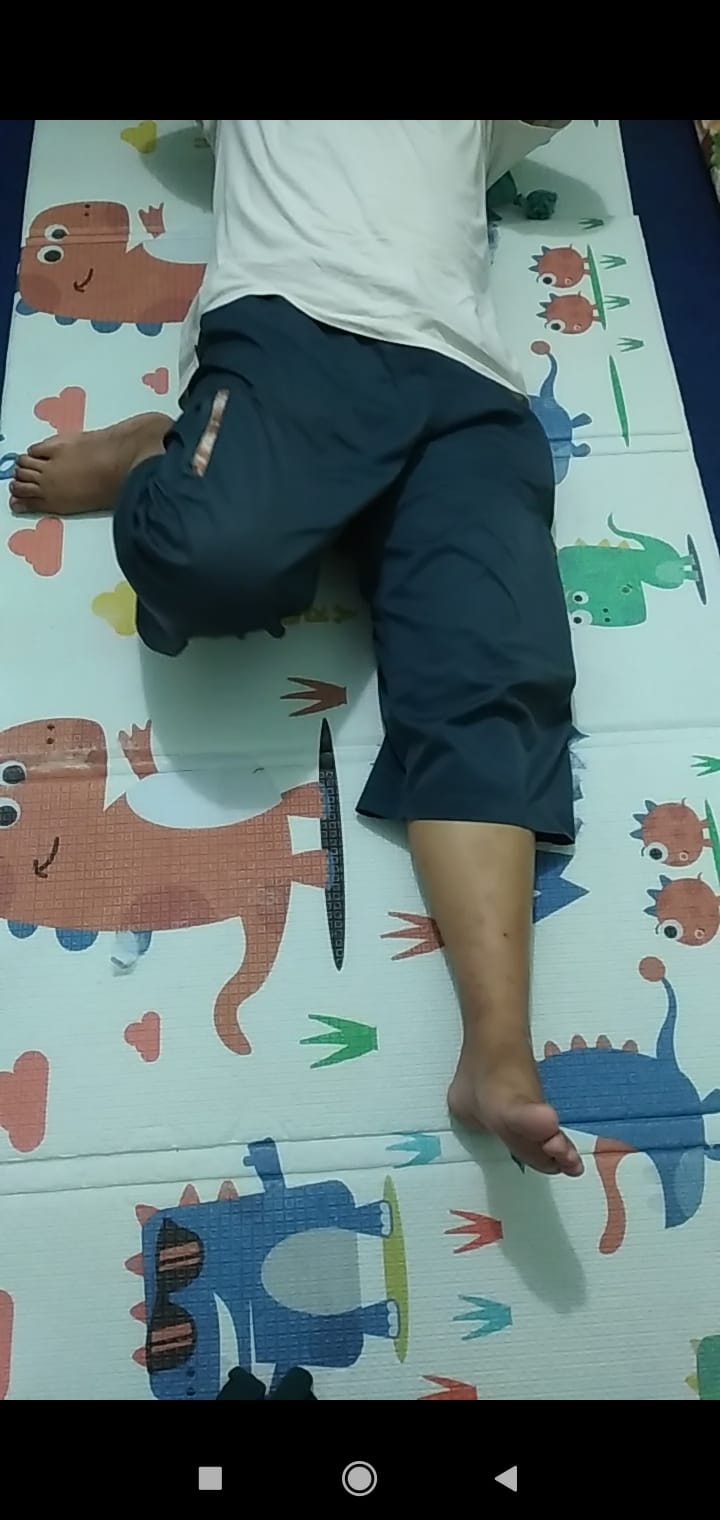 saraf-kejepit-dan-kaki-kanan-dan-kiri-sakit-sembuh-dengan-paz